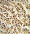 Sterol Regulatory Element Binding Transcription Factor 1 antibody, LS-C161494, Lifespan Biosciences, Immunohistochemistry paraffin image 