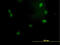 General Transcription Factor IIE Subunit 2 antibody, LS-C197378, Lifespan Biosciences, Immunofluorescence image 