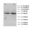 Carbonic Anhydrase 3 antibody, orb27663, Biorbyt, Western Blot image 