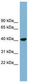 PIN2 (TERF1) Interacting Telomerase Inhibitor 1 antibody, TA344956, Origene, Western Blot image 