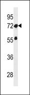 Zinc Finger Protein 286A antibody, PA5-72102, Invitrogen Antibodies, Western Blot image 