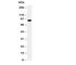 Colony Stimulating Factor 3 Receptor antibody, R31006, NSJ Bioreagents, Western Blot image 