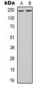 RNA Polymerase II Subunit A antibody, orb338878, Biorbyt, Western Blot image 