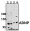 Activity Dependent Neuroprotector Homeobox antibody, A01855-1, Boster Biological Technology, Western Blot image 