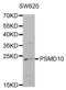 Proteasome 26S Subunit, Non-ATPase 10 antibody, abx001592, Abbexa, Western Blot image 