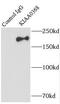 Ecm29 Proteasome Adaptor And Scaffold antibody, FNab04531, FineTest, Immunoprecipitation image 