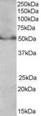 Peroxisome Proliferator Activated Receptor Delta antibody, PA5-18299, Invitrogen Antibodies, Western Blot image 