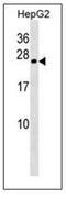 Crystallin Gamma B antibody, AP51092PU-N, Origene, Western Blot image 