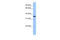 Annexin A8 Like 1 antibody, 25-367, ProSci, Enzyme Linked Immunosorbent Assay image 