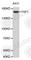 Thrombospondin 1 antibody, A1407, ABclonal Technology, Western Blot image 