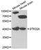 Serine/Threonine Kinase 32A antibody, LS-C349270, Lifespan Biosciences, Western Blot image 