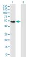 Choline Kinase Beta antibody, H00001120-B01P, Novus Biologicals, Western Blot image 