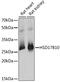 Hydroxysteroid 17-Beta Dehydrogenase 10 antibody, 19-669, ProSci, Western Blot image 