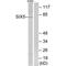 SIX Homeobox 5 antibody, PA5-50048, Invitrogen Antibodies, Western Blot image 