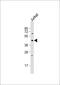 Casein Kinase 1 Epsilon antibody, 62-885, ProSci, Western Blot image 