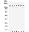 Discs Large MAGUK Scaffold Protein 1 antibody, R32206, NSJ Bioreagents, Western Blot image 