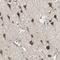 Prefoldin subunit 1 antibody, NBP1-87294, Novus Biologicals, Immunohistochemistry paraffin image 