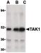 Mitogen-Activated Protein Kinase Kinase Kinase 7 antibody, PA5-20083, Invitrogen Antibodies, Western Blot image 