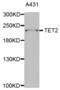 Tet Methylcytosine Dioxygenase 2 antibody, abx004345, Abbexa, Western Blot image 