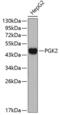 Phosphoglycerate Kinase 2 antibody, 19-248, ProSci, Western Blot image 