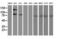 Alcohol Dehydrogenase 1B (Class I), Beta Polypeptide antibody, M01316, Boster Biological Technology, Western Blot image 