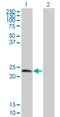 Tumor Protein D52 antibody, H00007163-M01, Novus Biologicals, Western Blot image 