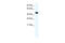 Peroxisome Proliferator Activated Receptor Delta antibody, 28-753, ProSci, Western Blot image 