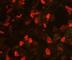 Interleukin 1 Receptor Associated Kinase 4 antibody, DDX0340A546-100, Novus Biologicals, Immunofluorescence image 