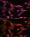 Citrulline--aspartate ligase antibody, GTX66412, GeneTex, Immunocytochemistry image 