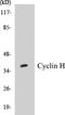 Cyclin H antibody, EKC1159, Boster Biological Technology, Western Blot image 