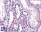 Lysophosphatidylcholine Acyltransferase 1 antibody, LS-A9904, Lifespan Biosciences, Immunohistochemistry paraffin image 