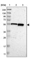 Chromosome 17 Open Reading Frame 80 antibody, PA5-53008, Invitrogen Antibodies, Western Blot image 