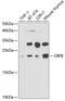 Core-Binding Factor Subunit Beta antibody, GTX33066, GeneTex, Western Blot image 