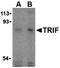 Toll Like Receptor Adaptor Molecule 1 antibody, orb74511, Biorbyt, Western Blot image 