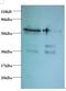 Tax1 Binding Protein 3 antibody, LS-C211675, Lifespan Biosciences, Western Blot image 