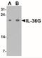 Interleukin 36 Gamma antibody, NBP2-41240, Novus Biologicals, Western Blot image 