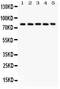 Calpain 1 antibody, PB9330, Boster Biological Technology, Western Blot image 