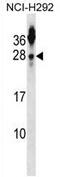 Tetraspanin 2 antibody, AP54378PU-N, Origene, Western Blot image 