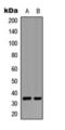 Uncoupling Protein 3 antibody, orb393182, Biorbyt, Western Blot image 