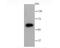 Glucose-6-Phosphate Dehydrogenase antibody, A00287-1, Boster Biological Technology, Western Blot image 