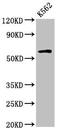 Interleukin 10 Receptor Subunit Alpha antibody, LS-C678298, Lifespan Biosciences, Western Blot image 