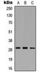Matrix metalloproteinase-26 antibody, LS-C354427, Lifespan Biosciences, Western Blot image 