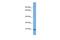 ST8 Alpha-N-Acetyl-Neuraminide Alpha-2,8-Sialyltransferase 1 antibody, PA5-42727, Invitrogen Antibodies, Western Blot image 