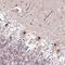 DNA Polymerase Alpha 2, Accessory Subunit antibody, NBP1-82139, Novus Biologicals, Immunohistochemistry frozen image 