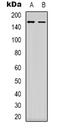 Mitogen-Activated Protein Kinase Kinase Kinase 1 antibody, orb339004, Biorbyt, Western Blot image 