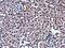 High Mobility Group Box 1 antibody, GTX629403, GeneTex, Immunohistochemistry paraffin image 