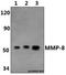 Matrix Metallopeptidase 8 antibody, GTX66623, GeneTex, Western Blot image 