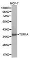 Torsin Family 1 Member A antibody, LS-C192759, Lifespan Biosciences, Western Blot image 