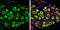 Ubiquitin C-Terminal Hydrolase L1 antibody, GTX109646, GeneTex, Immunohistochemistry paraffin image 