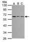 ANTXR Cell Adhesion Molecule 1 antibody, GTX116952, GeneTex, Western Blot image 